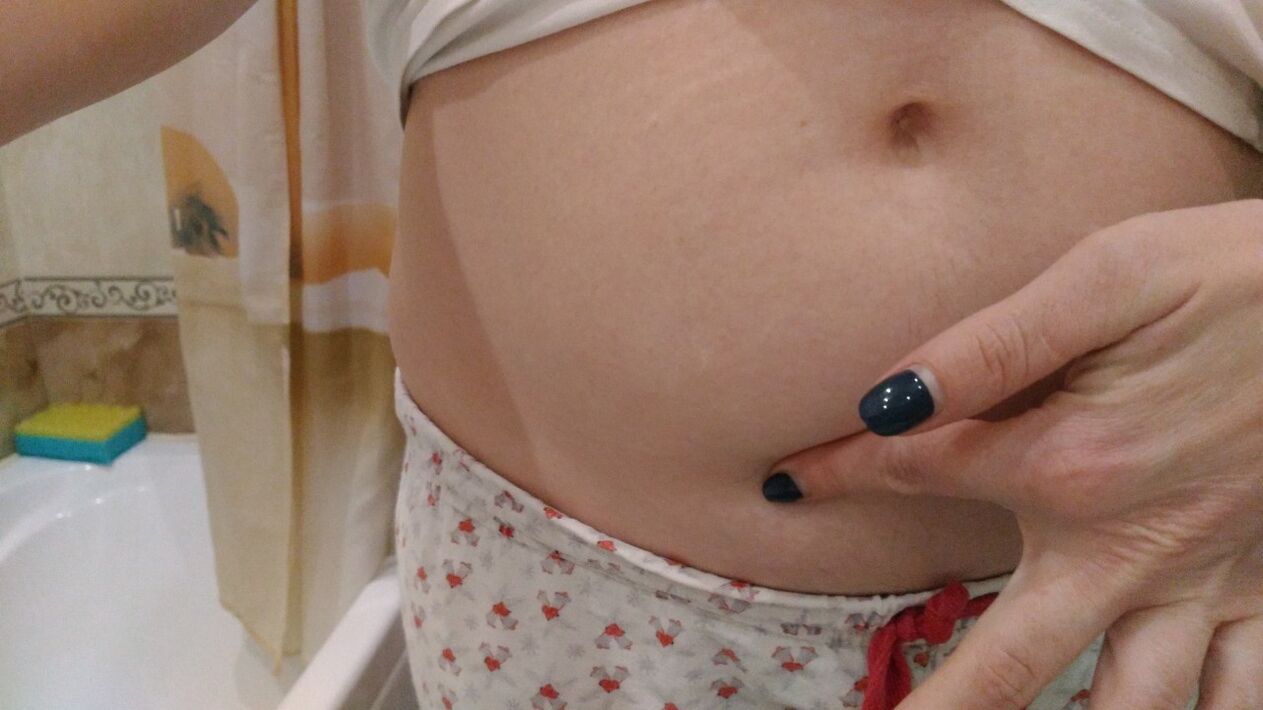 Helminti nakatumise tunnused isiklikust kogemusest