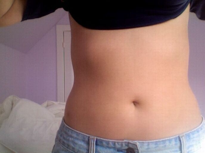 NEOfloraxi kapslitega ravi tulemus