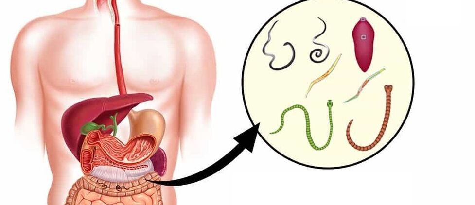 Parasiidid inimese kehas