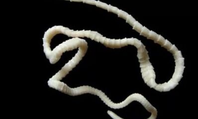 kuidas eemaldada tsestoodiparasiit kehast