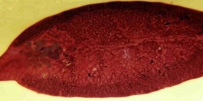 trematood parasiit kuidas eemaldada kehast