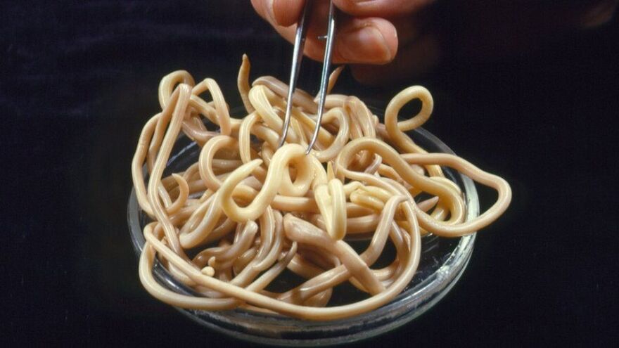 parasiidid inimkehast