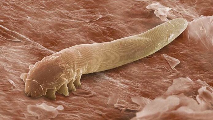 Subkutaanne parasiit mikroskoobi all